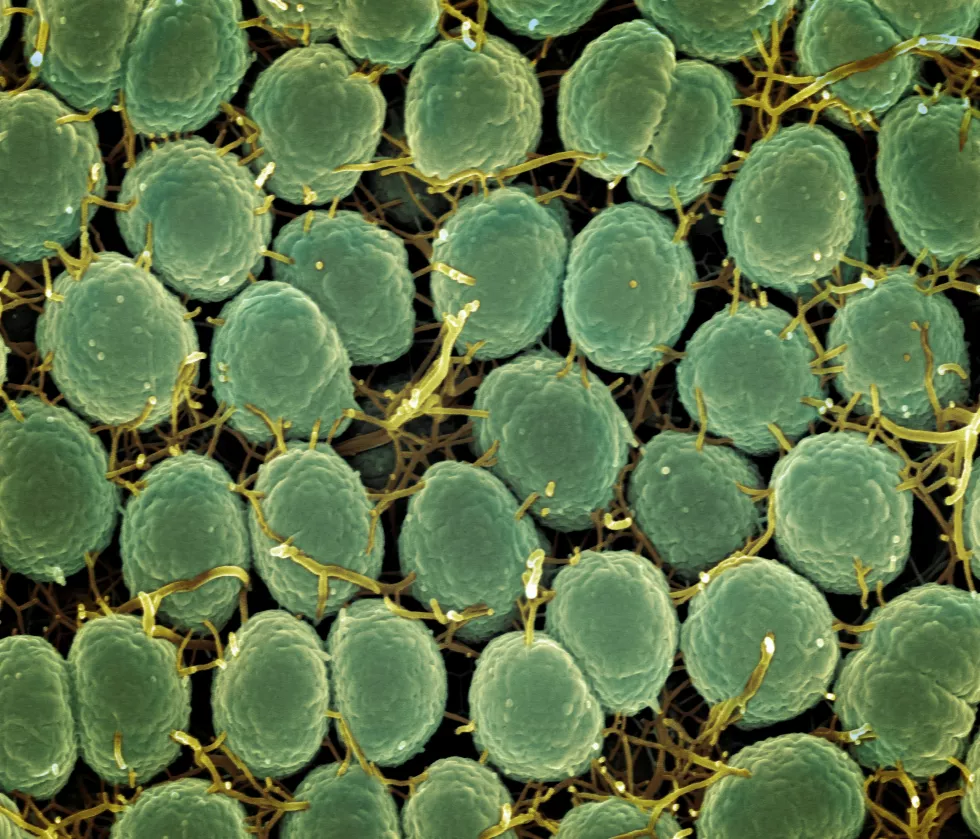 national-institute-of-allergy-and-infectious-diseases-HI7L5ptKsLQ-unsplash